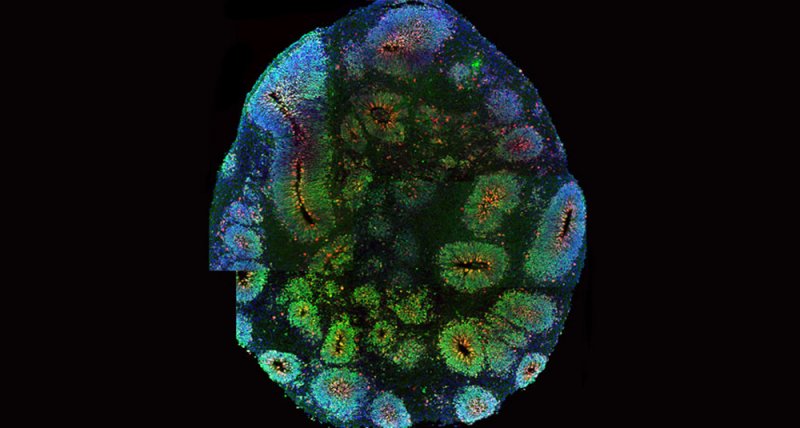 Clues To Autism Schizophrenia Emerge >> Albilad Big Data Reveals Hints Of How When And Where Mental Clues To Autism Schizophrenia Emerge >> Albilad Big Data Reveals Hints Of How When And Where Mental