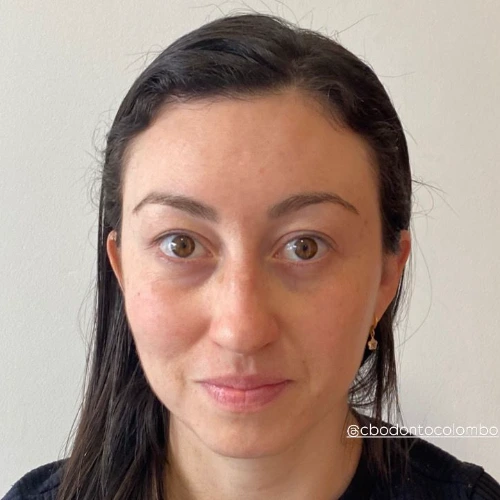 Harmonização Orofacial