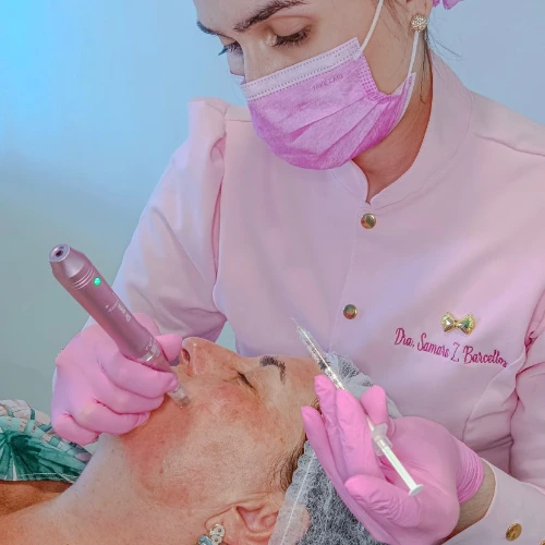 Microagulhamento Facial