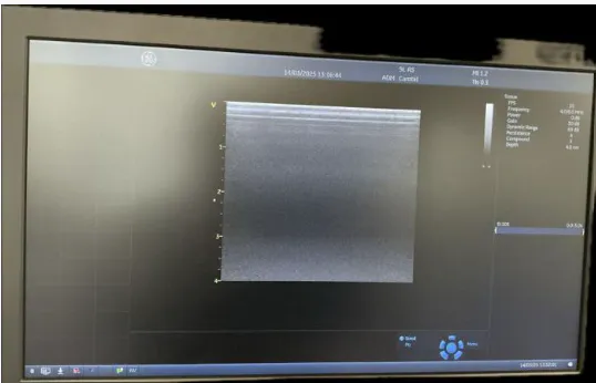 Pre-owned / Used 2020 GE HEALTHCARE Vivid T9 CARDIOVASCULAR ULTRASOUND IMAGING SYSTEM for Sale - photo 2