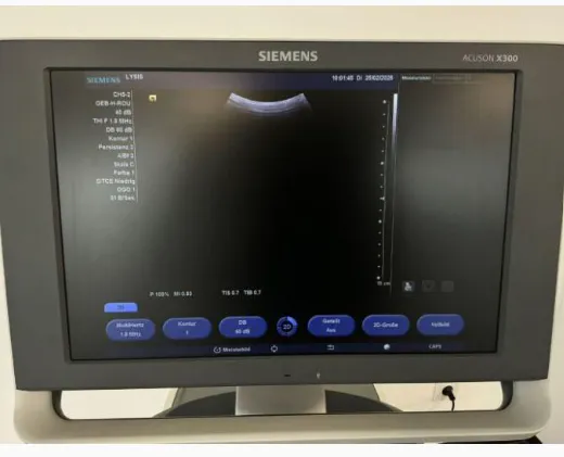 Pre-owned / Used 2017 SIEMENS HEALTHCARE Acuson X300 Premium Edition ULTRASOUND SCANNERS for Sale - photo 10