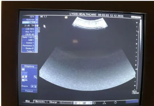 Pre-owned / Used 2011 SIEMENS HEALTHCARE Acuson X300 ULTRASOUND SCANNERS for Sale - photo 12