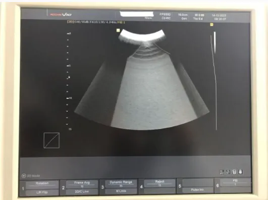 Pre-owned / Used 2009 SAMSUNG MEDISON Accuvix V10 ULTRASOUND SCANNERS for Sale - photo 7