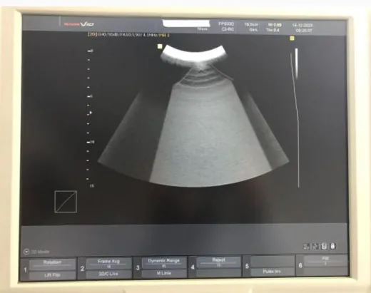 Pre-owned / Used 2008 SAMSUNG MEDISON Accuvix V10 ULTRASOUND SCANNERS for Sale - photo 6