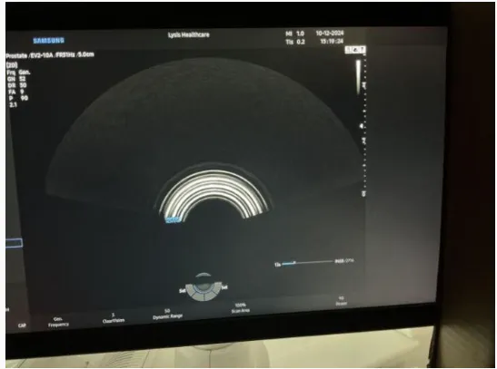 Pre-owned / Used 2021 SAMSUNG MEDISON HERA I10 ULTRASOUND SCANNERS for Sale - photo 10