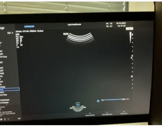 Pre-owned / Used 2021 SAMSUNG MEDISON HERA I10 ULTRASOUND SCANNERS for Sale - photo 11