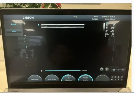 Pre-owned / Used 2024 CHISON MEDICAL SONOAIR 30 ULTRASOUND SCANNERS for Sale - photo 5