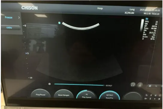 Pre-owned / Used 2024 CHISON MEDICAL SONOAIR 30 ULTRASOUND SCANNERS for Sale - photo 7