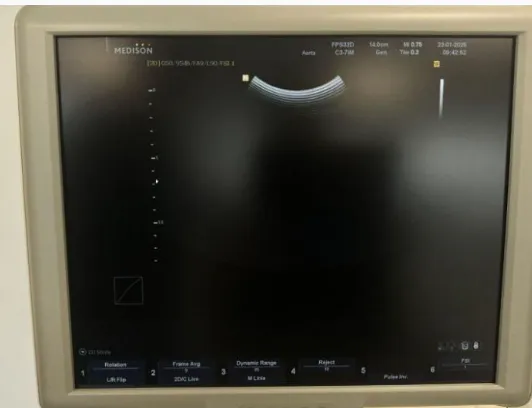 Pre-owned / Used 2010 SAMSUNG MEDISON Accuvix V10 ULTRASOUND SCANNERS for Sale - photo 9