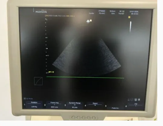 Pre-owned / Used 2010 SAMSUNG MEDISON Accuvix V10 ULTRASOUND SCANNERS for Sale - photo 13