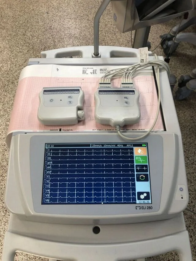 Pre-owned / Used 2010 MORTARA ELI 280 ELECTROCARDIOGRAPH for Rent/Lease - photo 5