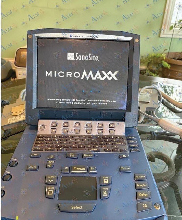 Pre-owned / Used 2010 SONOSITE MicroMaxx BREAST ULTRASOUND IMAGING SYSTEM for Sale - photo 3