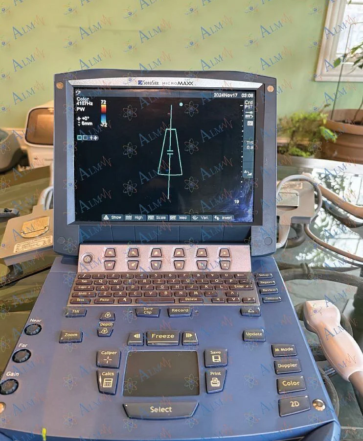 Pre-owned / Used 2010 SONOSITE MicroMaxx BREAST ULTRASOUND IMAGING SYSTEM for Sale - photo 5