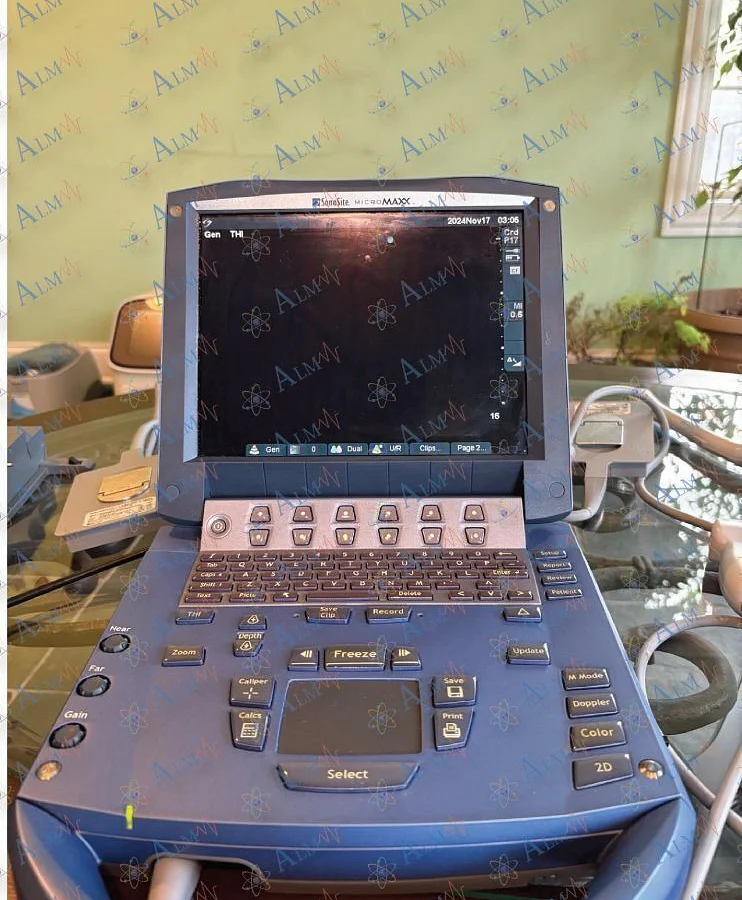 Pre-owned / Used 2010 SONOSITE MicroMaxx BREAST ULTRASOUND IMAGING SYSTEM for Sale - photo 6