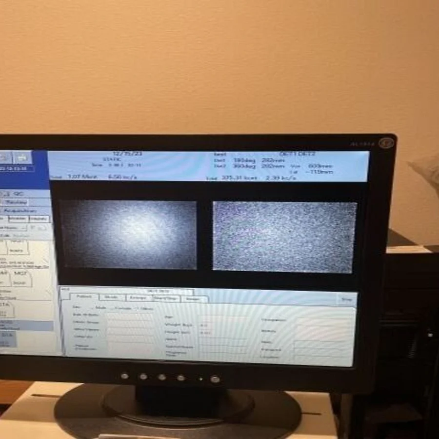 Pre-owned / Used 2011 GE MEDICAL MILLENIUM GAMMA CAMERAS for Sale - photo 2