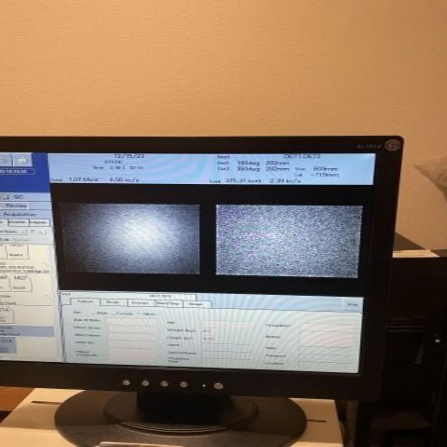 Pre-owned / Used 2011 GE HEALTHCARE Millennium SPECT SYSTEMS for Sale - photo 4