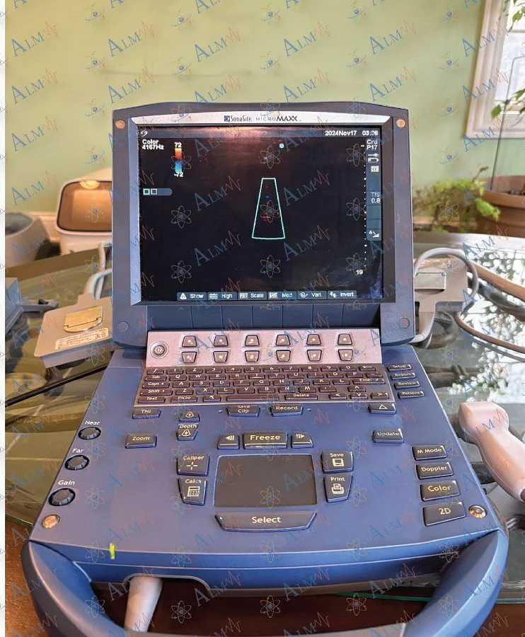 Pre-owned / Used 2007 SONOSITE MicroMaxx ULTRASOUND SYSTEM ABDOMINAL ULTRASOUND SCANNERS for Sale - photo 3