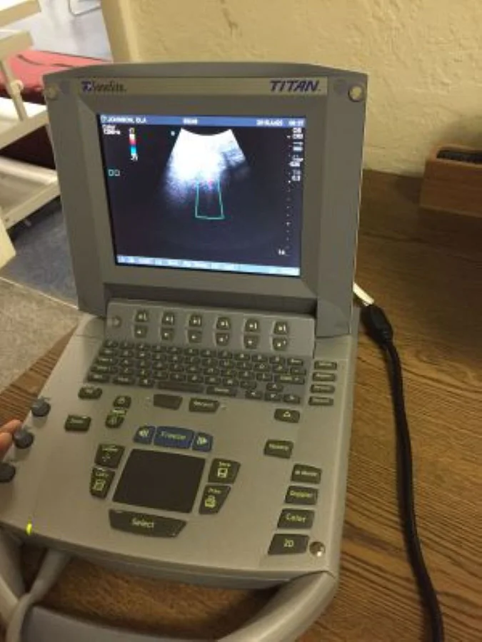 Pre-owned / Used 2003 SONOSITE Titan ULTRASOUND SCANNERS for Sale - photo 3