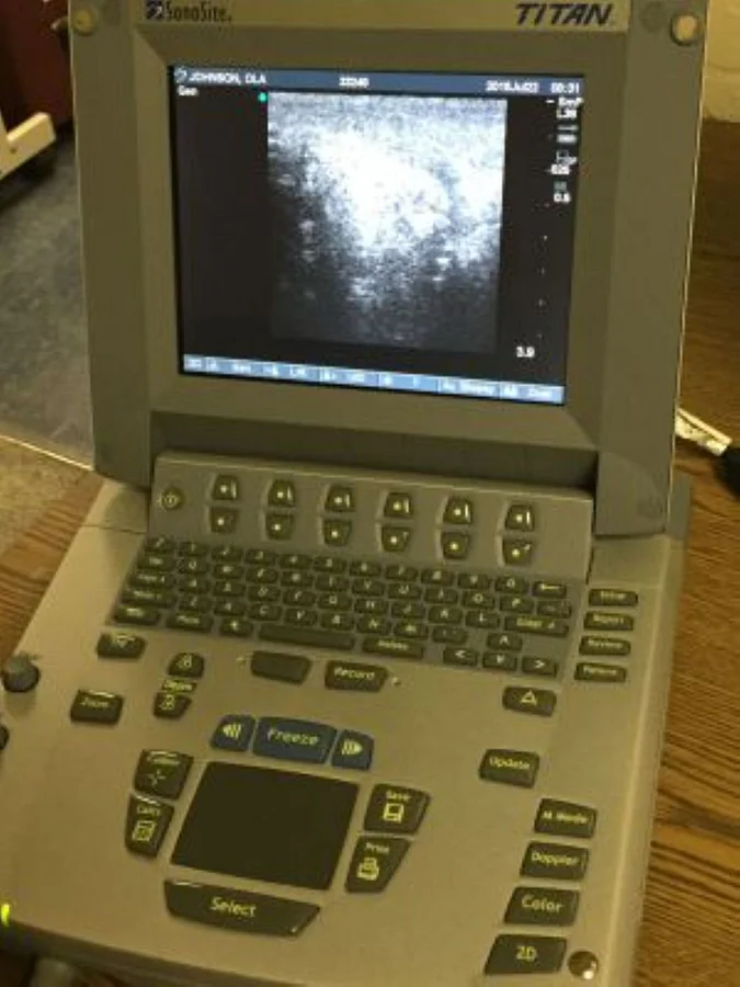 Pre-owned / Used 2003 SONOSITE Titan ULTRASOUND SCANNERS for Sale - photo 4