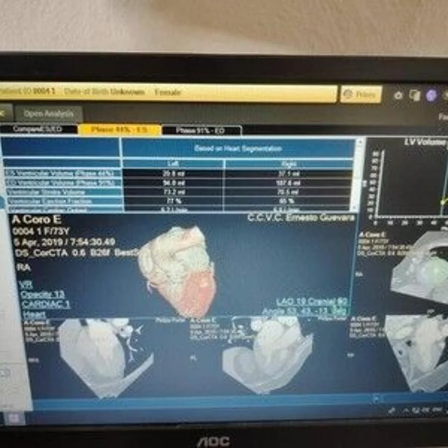 Pre-owned / Used 2021 PHILIPS HEALTHCARE IntelliSpacePortal V12-ISP V12 DIGITAL IMAGING SYSTEMS for Sale - photo 2