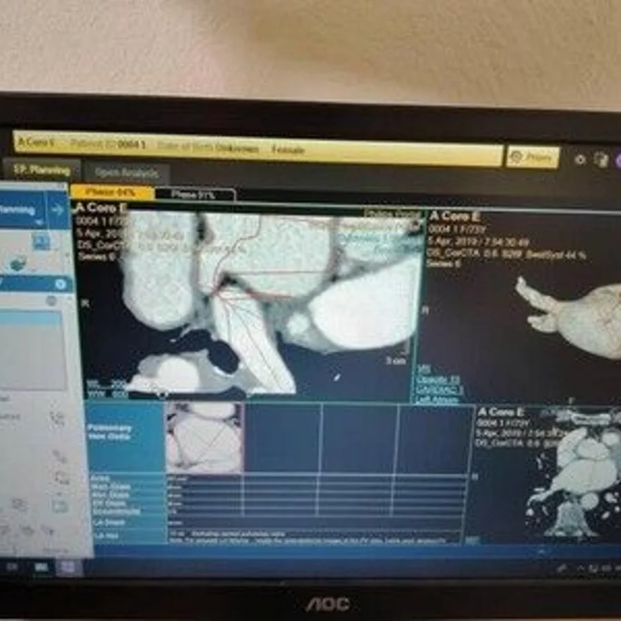 Pre-owned / Used 2021 PHILIPS HEALTHCARE IntelliSpacePortal V12-ISP V12 DIGITAL IMAGING SYSTEMS for Sale - photo 3