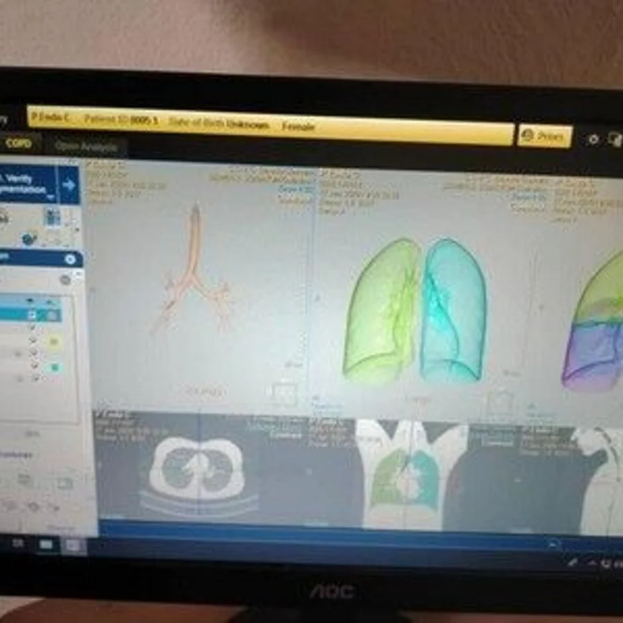 Pre-owned / Used 2021 PHILIPS HEALTHCARE IntelliSpacePortal V12-ISP V12 DIGITAL IMAGING SYSTEMS for Sale - photo 4