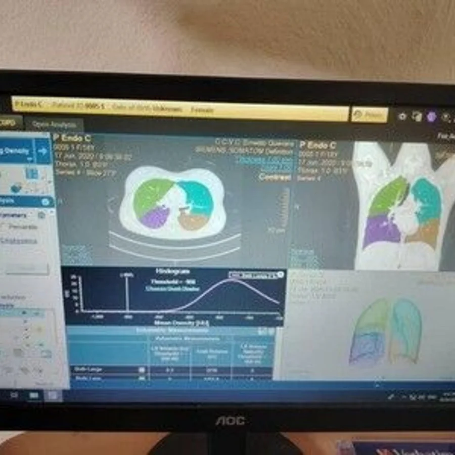 Pre-owned / Used 2021 PHILIPS HEALTHCARE IntelliSpacePortal V12-ISP V12 DIGITAL IMAGING SYSTEMS for Sale - photo 5