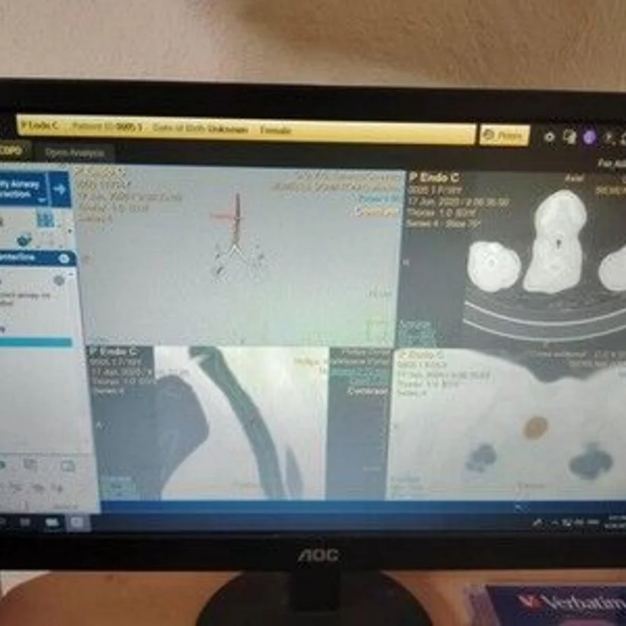 Pre-owned / Used 2021 PHILIPS HEALTHCARE IntelliSpacePortal V12-ISP V12 DIGITAL IMAGING SYSTEMS for Sale - photo 6