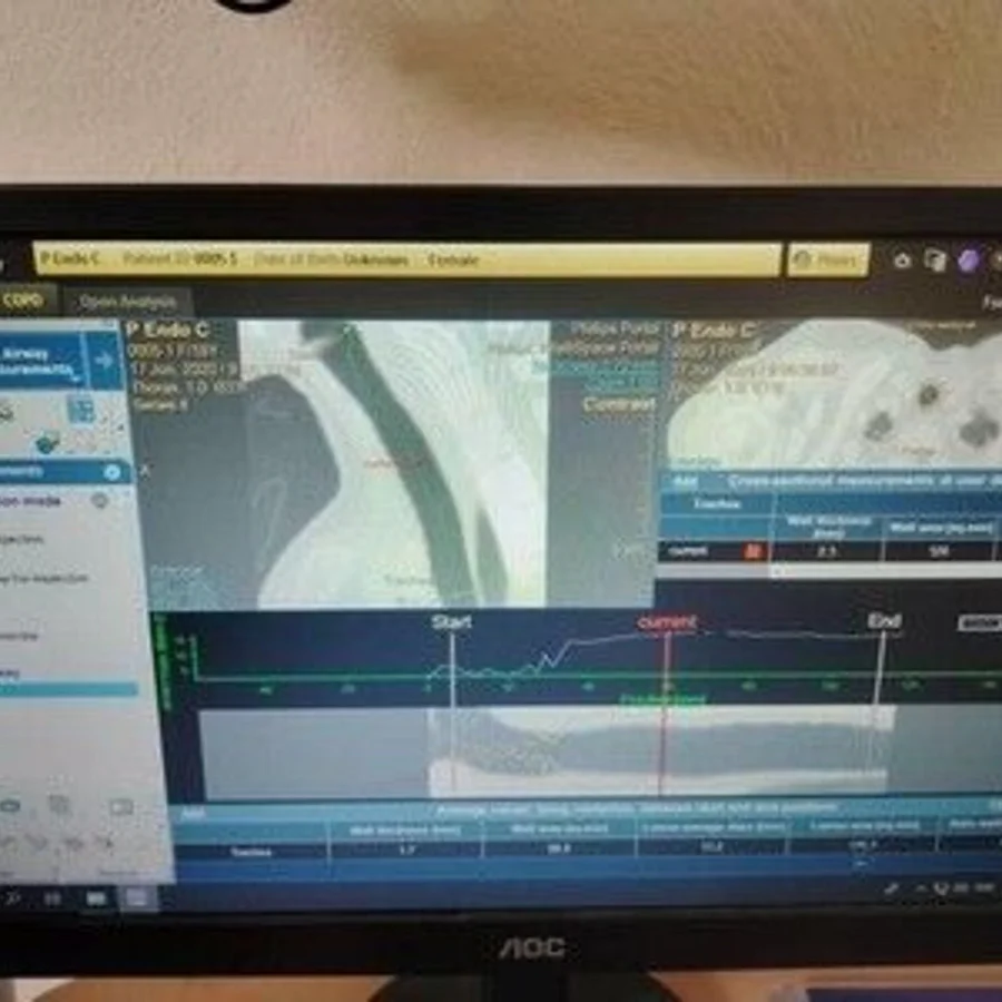 Pre-owned / Used 2021 PHILIPS HEALTHCARE IntelliSpacePortal V12-ISP V12 DIGITAL IMAGING SYSTEMS for Sale - photo 7
