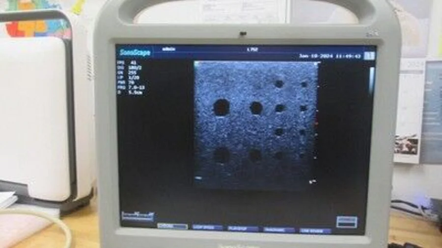 Pre-owned / Used 2010 SONOSCAPE S8 Diagnostic MOBILE ULTRASOUND SYSTEMS for Sale - photo 6