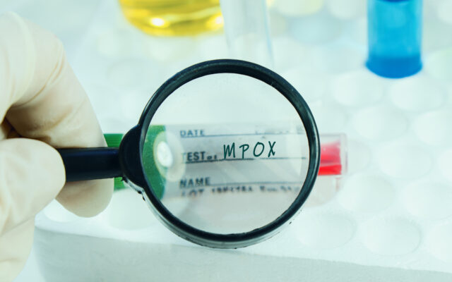 Mpox Web