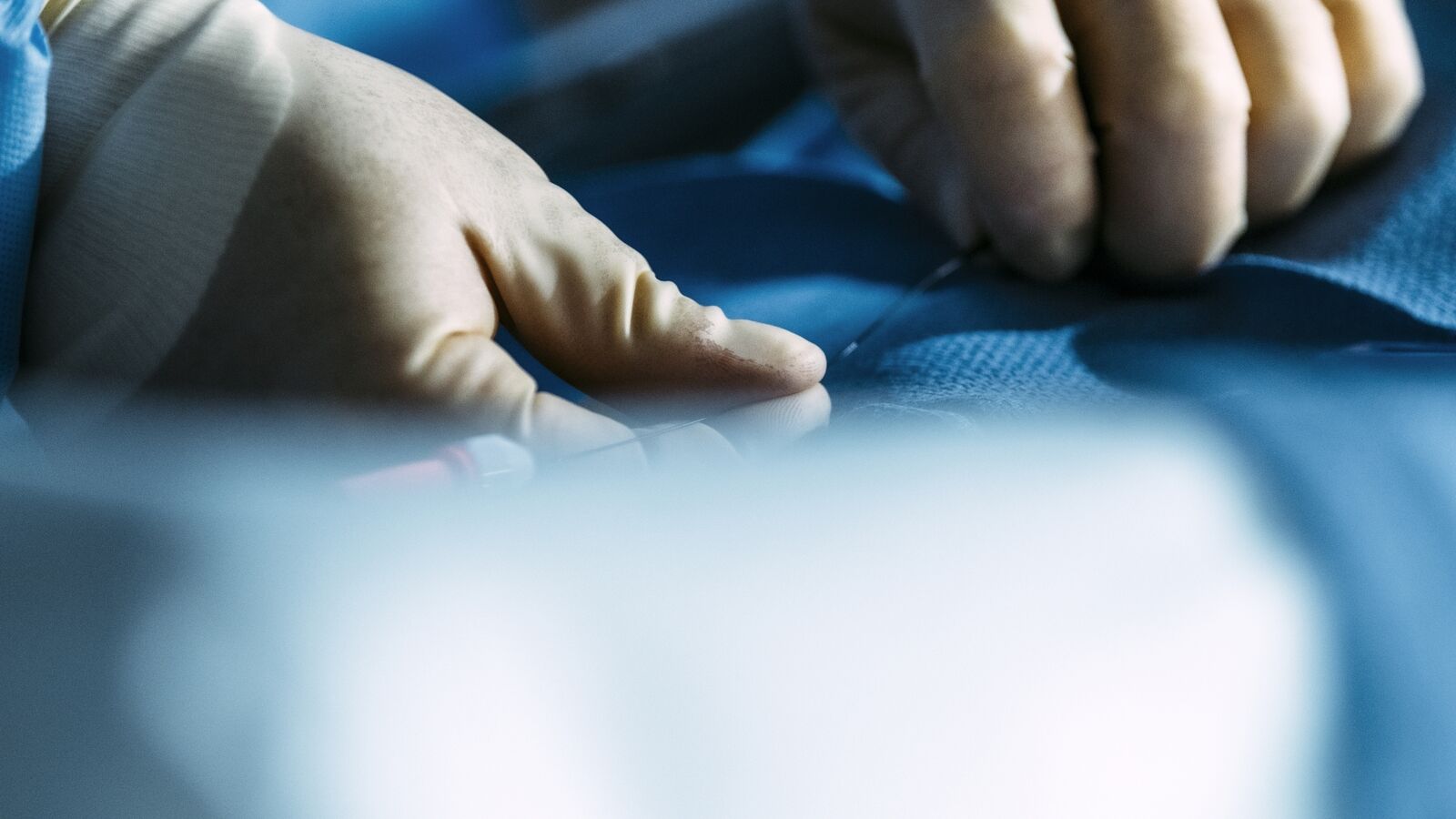 A close up of hands in gloves in a surgery environment
