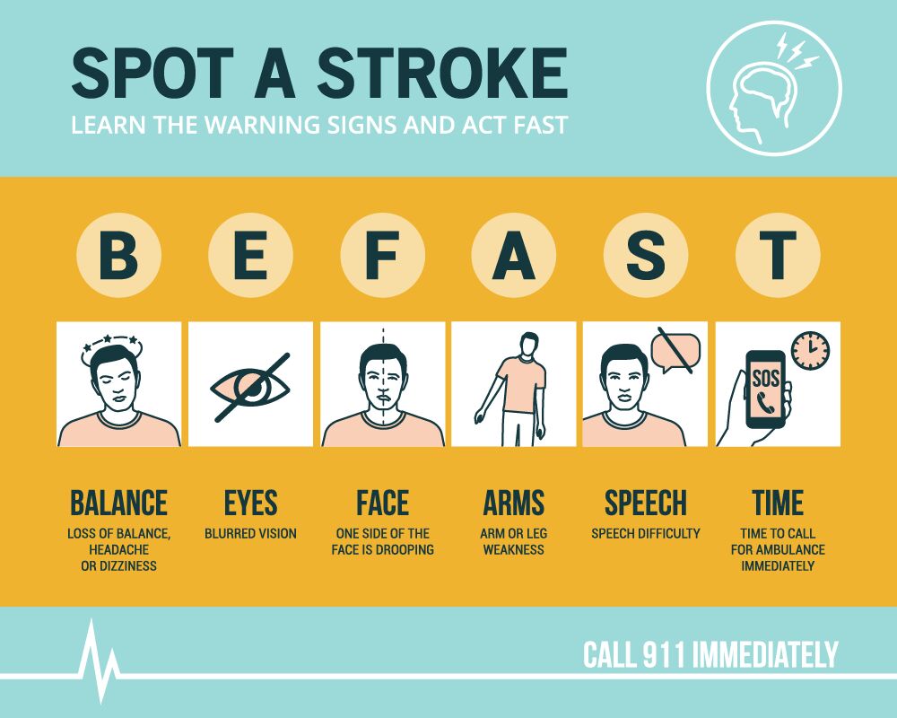 Be Fast Stroke Acronym