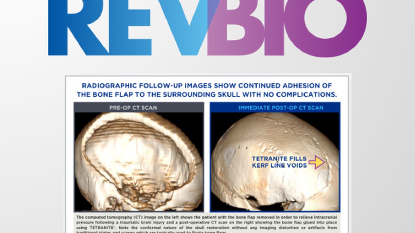 Michael Rev Bio trial
