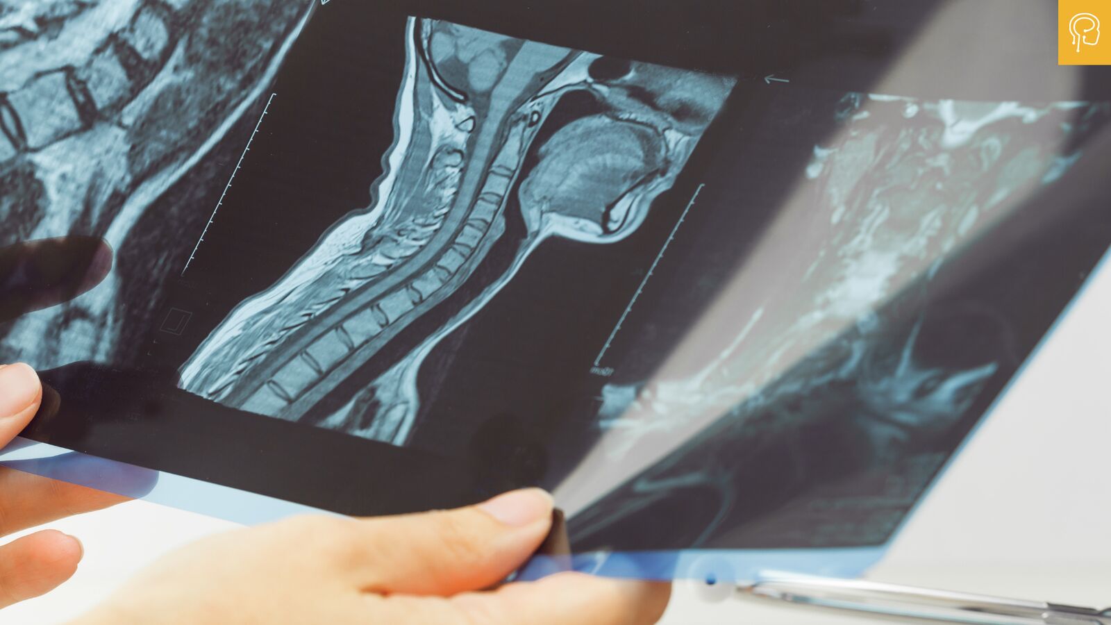 How do you know when neck pain is serious Blog Hero