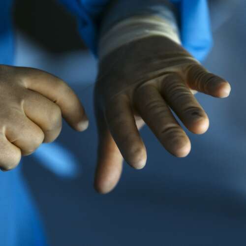 Close Up Image of Doctor Hands in Gloves with a Blue Background