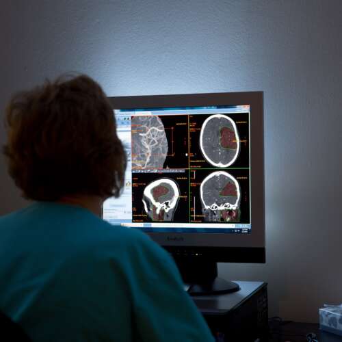 Nurse looking at mri images in a dark room