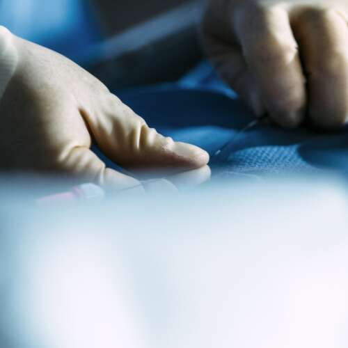 A close up of hands in gloves in a surgery environment