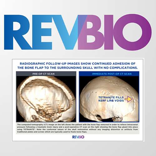 Michael Rev Bio trial