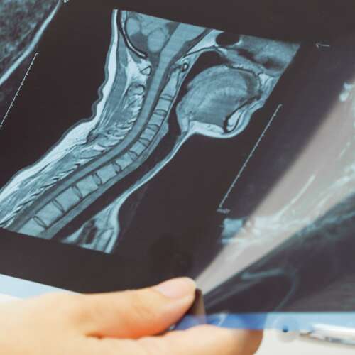 How do you know when neck pain is serious Blog Hero