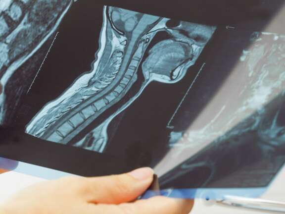 How do you know when neck pain is serious Blog Hero