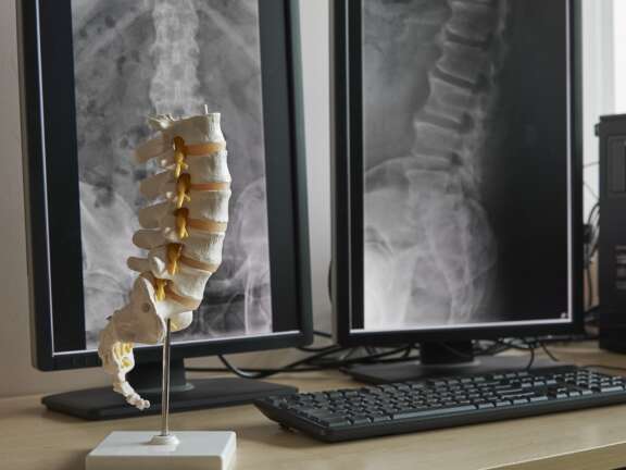 Spine 1