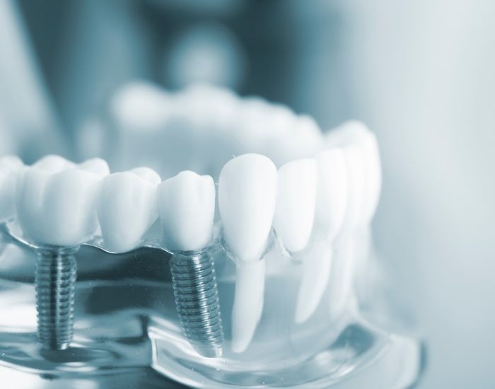 Which dentist in Chattanooga specializes in specific dental procedures?