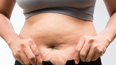 Stretch Marks Quotes