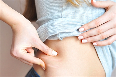 Sores In Stretch Marks