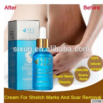 Tazorac For Stretch Marks