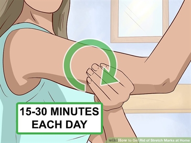 Stretch Marks Ointment