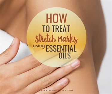 Micro Needling For Stretch Marks Before And After Pictures