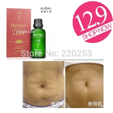 Teigen Stretch Marks