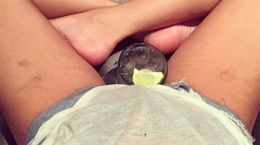 How Much Is Laser Therapy For Stretch Marks